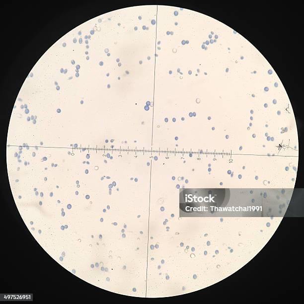 Cytology Smear Of Pleural Effusion Showing Candida Stock Photo - Download Image Now