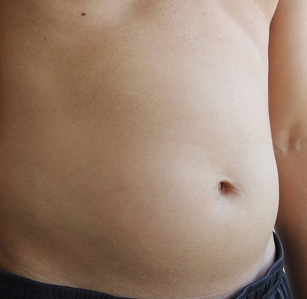 istock paunch fat person 497565386