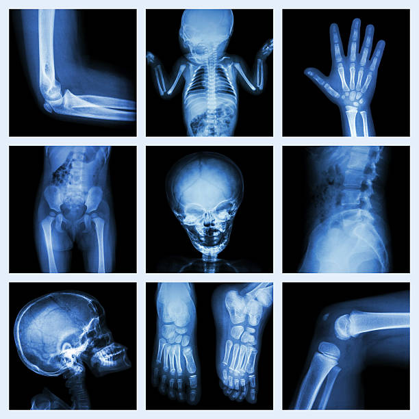 collezione radiografia parte del/la bambino/a - human lung x ray image x ray human spine foto e immagini stock