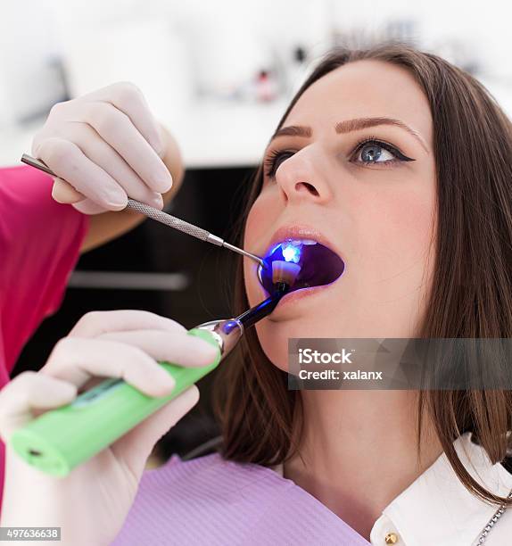 Dentist Using Ultraviolet Light On A Fill Of Patients Cavity Stock Photo - Download Image Now