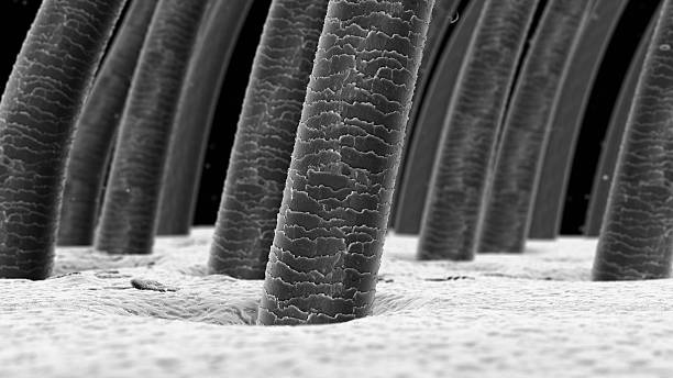istock Hair Follicles Microscopic 497685728