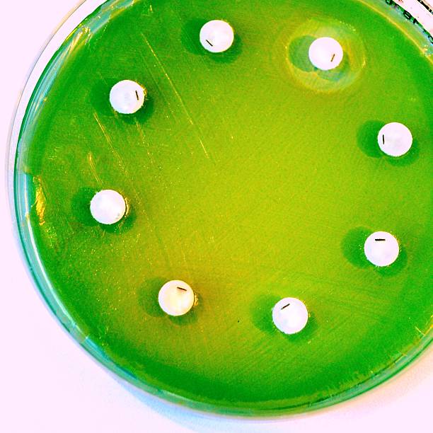 pseudomonas aeroginosa - bacterium colony laboratory pus - fotografias e filmes do acervo