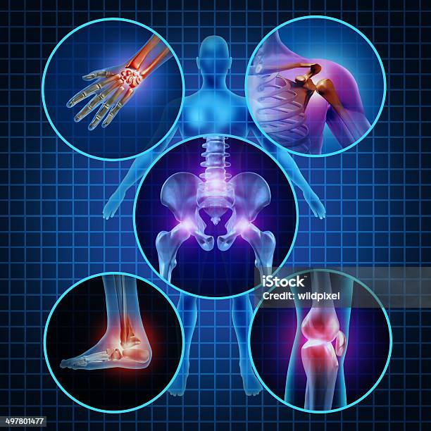 Dolori Articolazioni - Fotografie stock e altre immagini di Giuntura - Giuntura, Dolore fisico, Il corpo umano