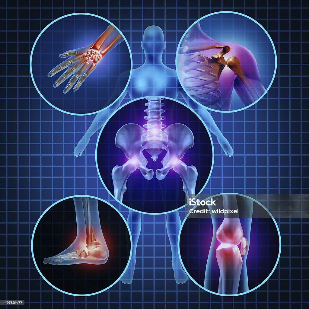 Painful Joints Painful joints human anatomy concept with the body as a group of circular panels of sore areas as a pain and injury or arthritis illness symbol for health care and medical symptoms due to aging or sports and work injury. Joint - Body Part Stock Photo