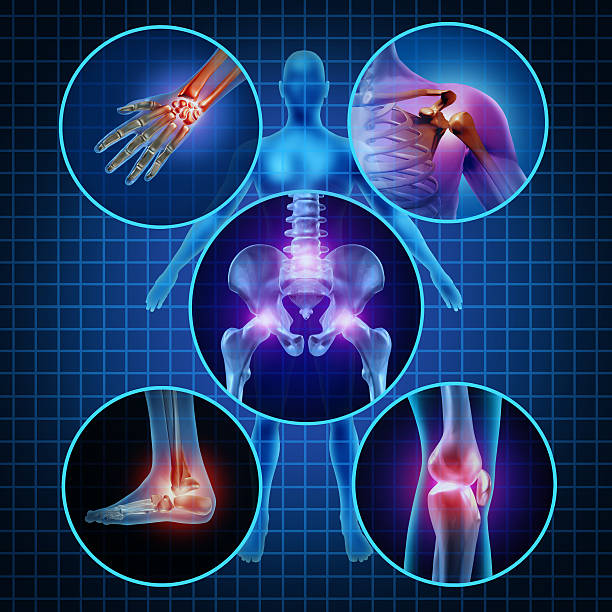 Painful Joints Painful joints human anatomy concept with the body as a group of circular panels of sore areas as a pain and injury or arthritis illness symbol for health care and medical symptoms due to aging or sports and work injury. human joints medical stock pictures, royalty-free photos & images