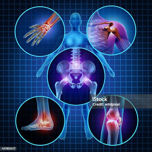 Painful Joints Stock Photo - Download Image Now - Joint - Body Part, Pain, The Human Body