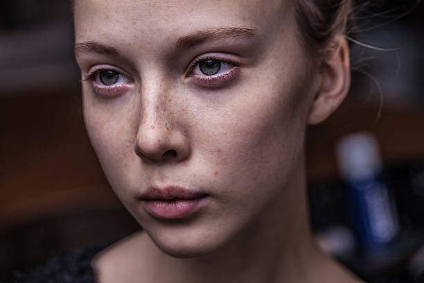 istock beautiful girl with freckles 497865886