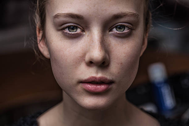 istock beautiful girl with freckles 497865940