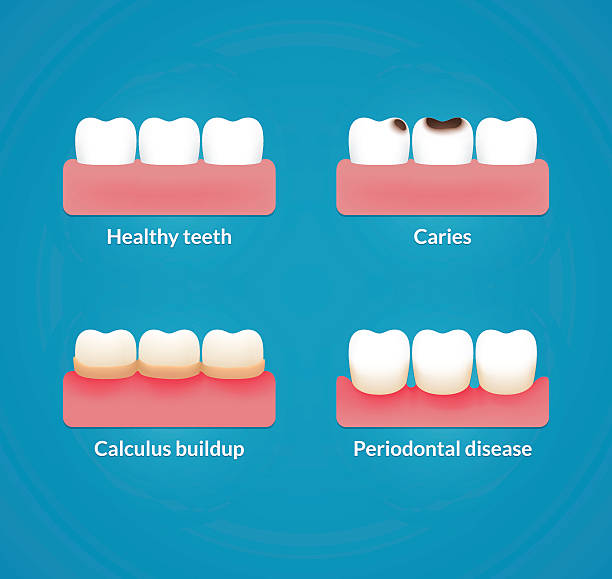 zdrowie jamy ustnej ilustracja - human teeth gums dental hygiene inflammation stock illustrations