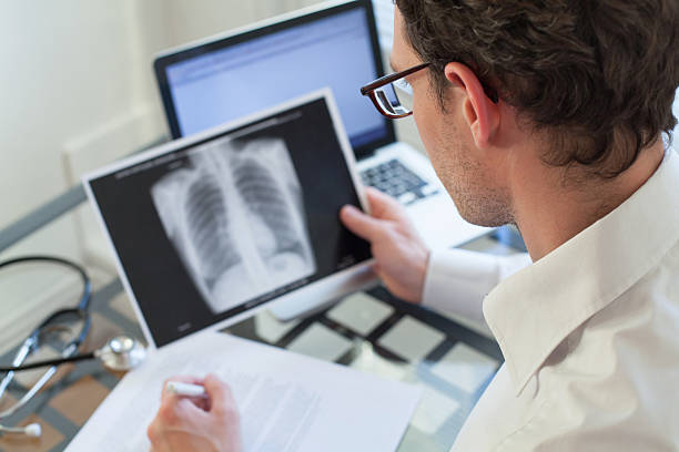 doctor looking at x-ray of lungs and writing diagnosis stock photo