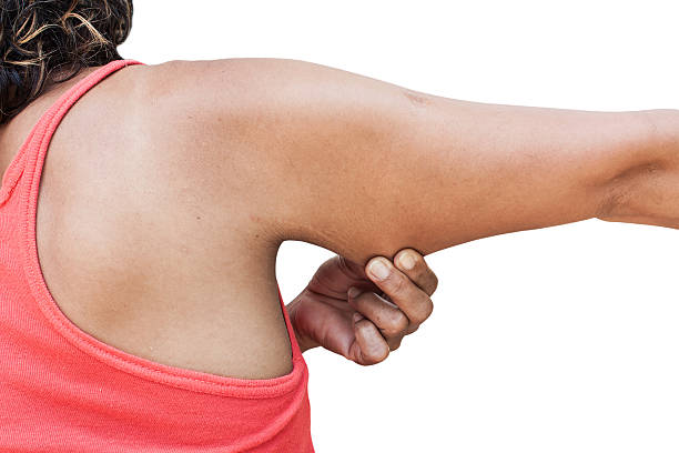 istock women show fat and scratch mark 497964048