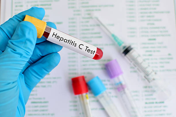 Hepatitis C testing Blood sample for hepatitis C virus testing hepatitis photos stock pictures, royalty-free photos & images