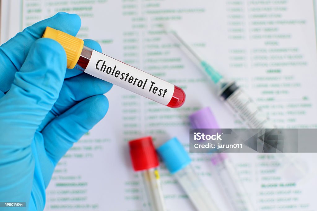 Cholesterol testing Blood sample for cholesterol testing Cholesterol Stock Photo