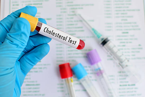 Cholesterol testing stock photo