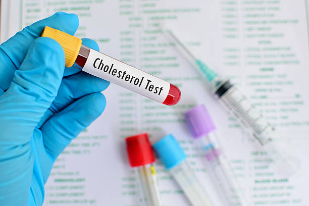 Cholesterol testing Blood sample for cholesterol testing vascular bundle stock pictures, royalty-free photos & images