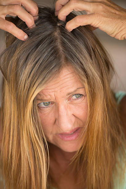 istock Stressed Woman tearing her hair with hands 498093254
