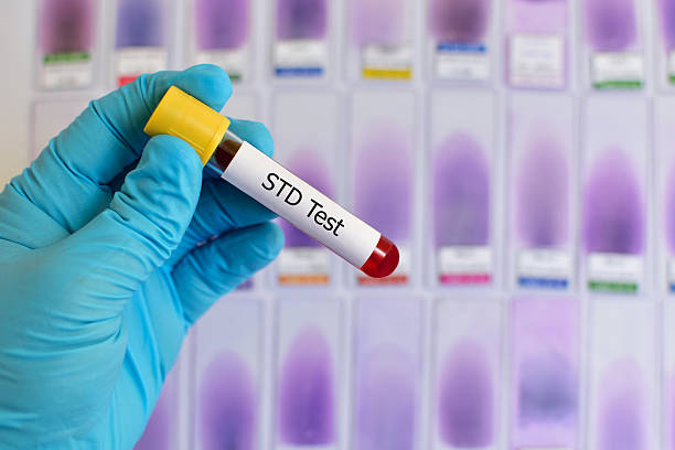 STD (Sexually Transmitted Diseases) test Blood sample for sexually transmitted diseases sti stock pictures, royalty-free photos & images