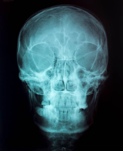 istock X-Ray Image Of Human  for a medical diagnosis 498402029