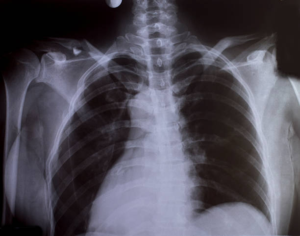 istock X-Ray Image Of Human for a medical diagnosis 498404813
