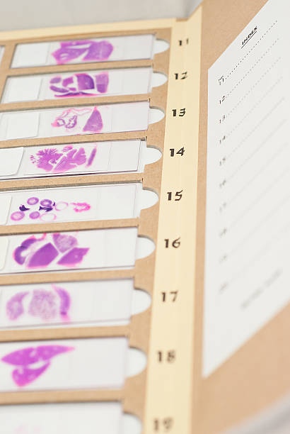 Slide Folder Lab 50+ Microscope Slide Histology Laboratory Box Stock Photos, Pictures ...