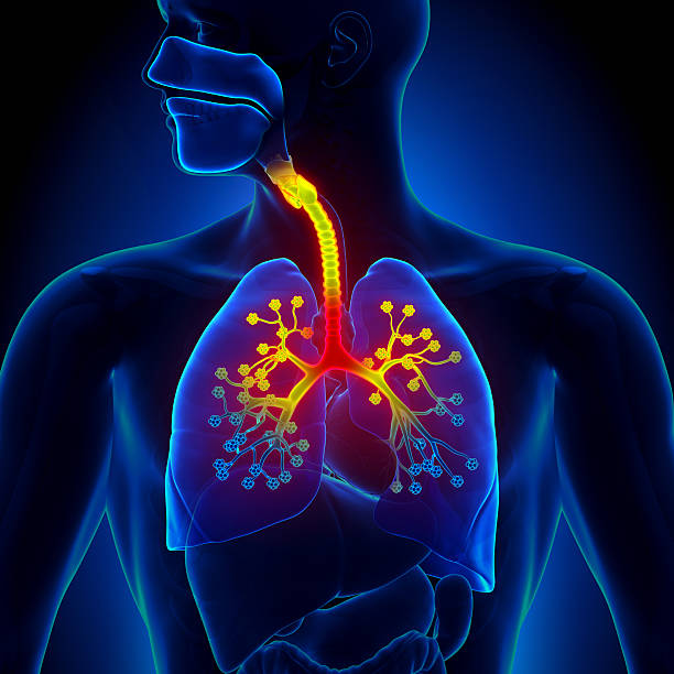 bronchiolitis - inflammation of the bronchioles - 咳嗽 插圖 個照片及圖片檔