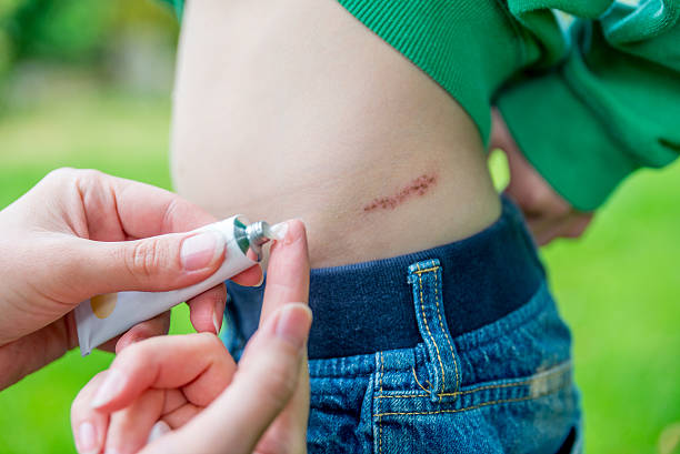 Mother making cream on the son scrape Mother making cream on the son scrape mark cream stock pictures, royalty-free photos & images