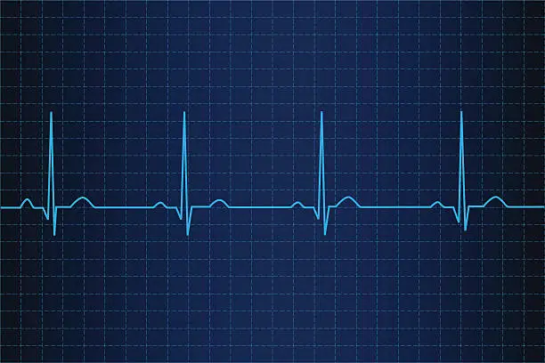 Vector illustration of Lifeline in an electrocardiogram