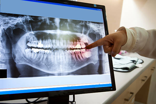 panoramique x-ray du film de chirurgie dentaire dentiste - radiogram photographic image photos et images de collection