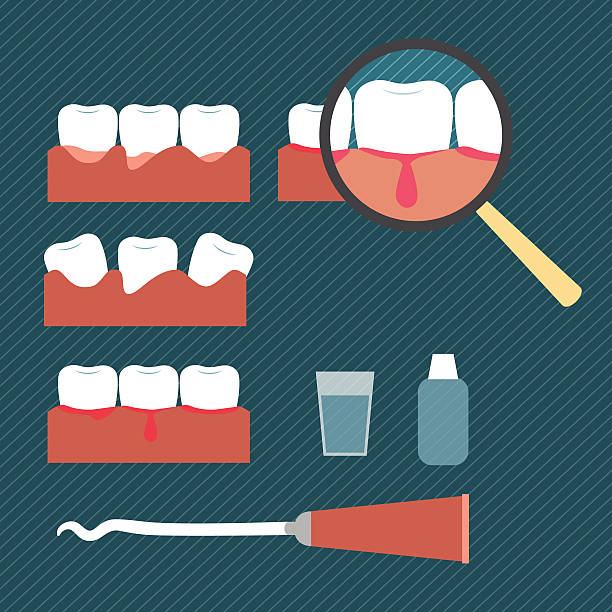 ilustracja z choroby dziąseł - human teeth gums dental hygiene inflammation stock illustrations