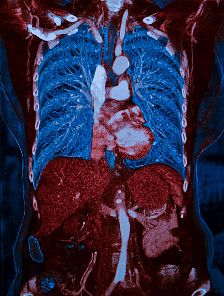 istock Lungs, heart and liver, CT 498746132
