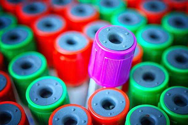 istock Close up medical test-tube with blood samples 498831324