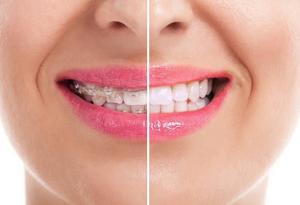 istock Healthy woman teeth 498836836