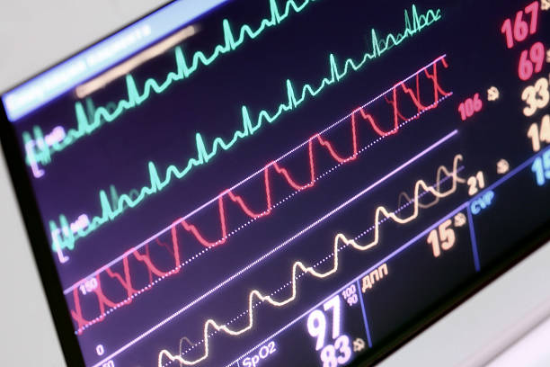 istock Monitoring of the patient in the ICU 498906818