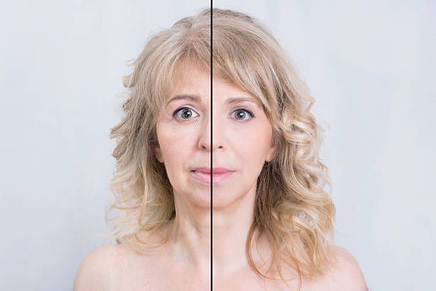 istock Before and after skin treatment 498944270