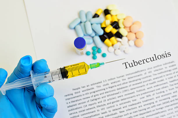 Tuberculosis treatment stock photo