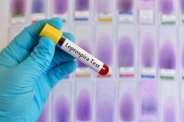 Leptospira test Blood sample for Leptospira bacteria test leptospira stock pictures, royalty-free photos & images