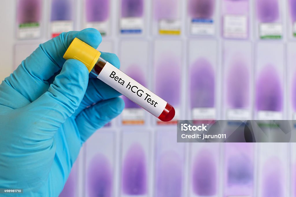 Beta hCG test Blood sample for beta hCG test (pregnancy hormone) Blood Stock Photo