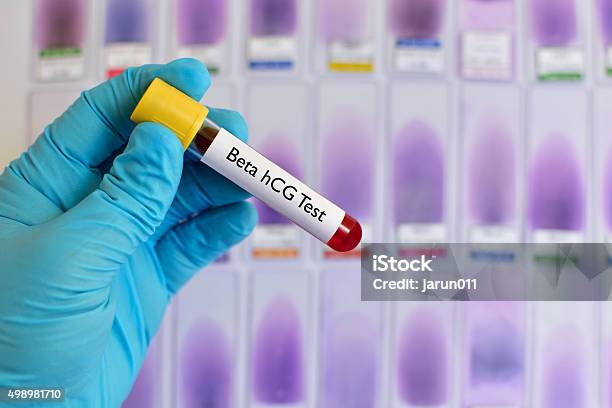 Beta Hcg Test Stock Photo - Download Image Now - Blood, Hormone, Laboratory