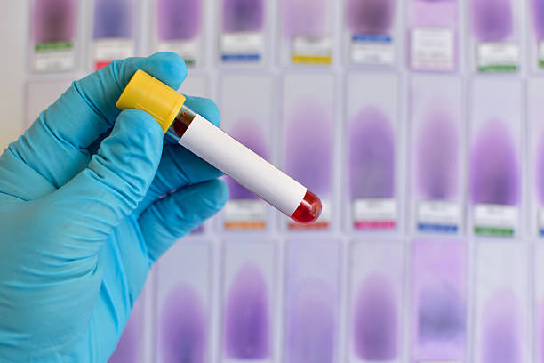muestra de sangre - blood sugar test fotografías e imágenes de stock