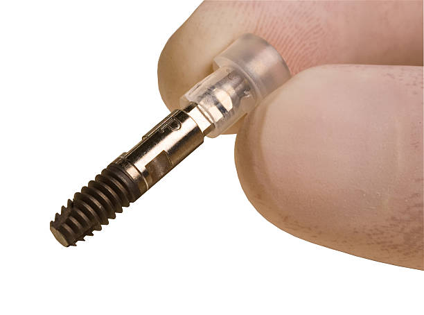 istock Osseo integrated implant 499131680