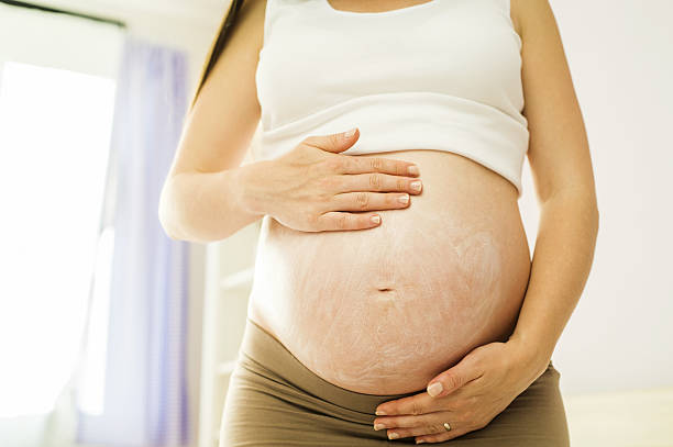 istock Pregnant woman appyling cream 499230629