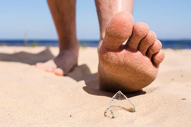 istock man on beach risk of stepping on broken bottle glass 499232414