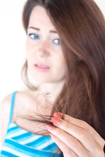 Very bad, damaged hair stock photo