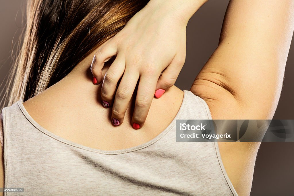 Woman scratching her back closeup Health problem. Closeup young woman scratching her itchy back with allergy rash 2015 Stock Photo