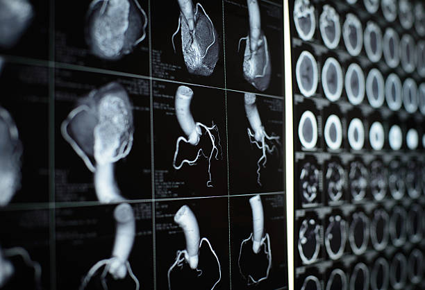 corazón humano y de la arteria coronaria images - imagen de rayos x fotos fotografías e imágenes de stock