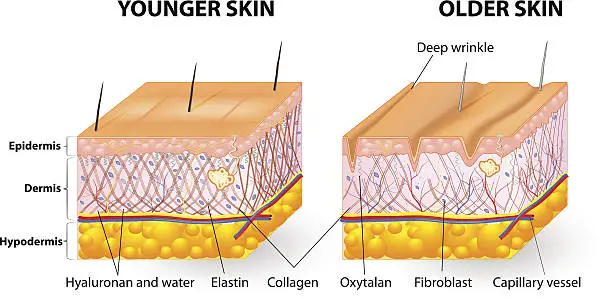 Vector illustration of skin aging