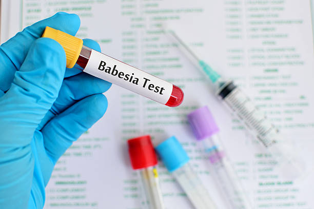 Babesia parasite testing Blood sample for babesia parasite testing malaria blood sample stock pictures, royalty-free photos & images