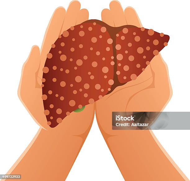 Mãos Segurar Cirrose Hepática - Arte vetorial de stock e mais imagens de Fígado - Órgão interno - Fígado - Órgão interno, Fibrose, Anatomia