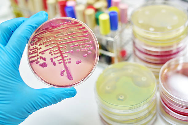 cultura de bactérias - bacterial colonies imagens e fotografias de stock