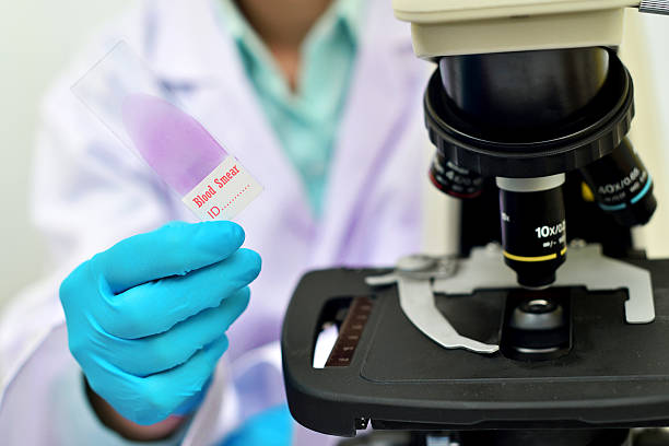 Blood smear Blood smear for microscopic examination malaria blood sample stock pictures, royalty-free photos & images